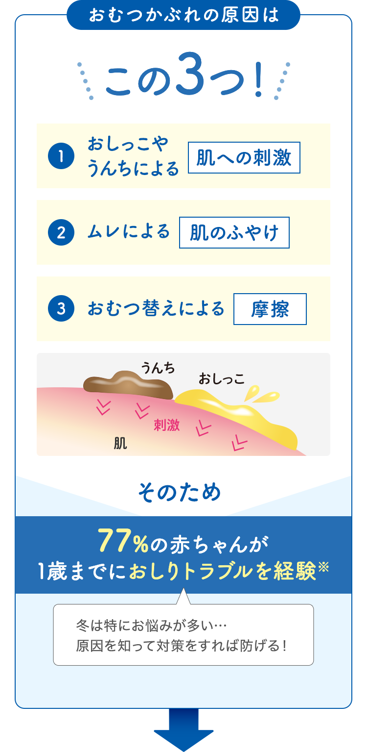 おむつかぶれの原因はこの3つ！ 1.おしっこやうんちによる肌への刺激 2.ムレによる肌のふやけ 3.おむつ替えによる摩擦