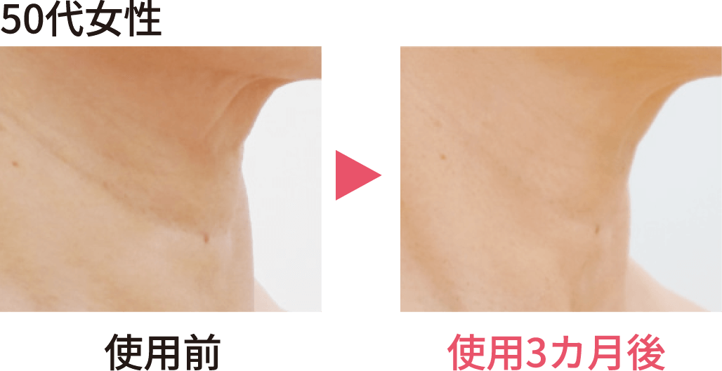 50代女性の使用前後の比較画像