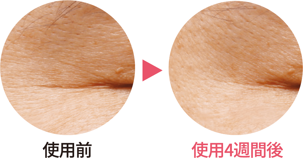 使用前後の比較画像