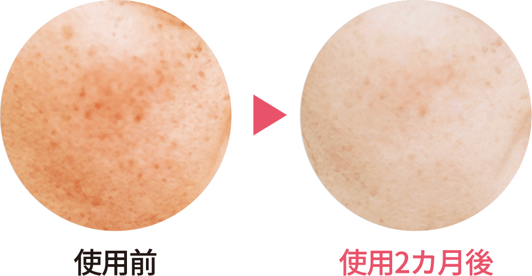 使用前後の肌の変化の比較画像