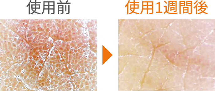 使用前後の比較画像