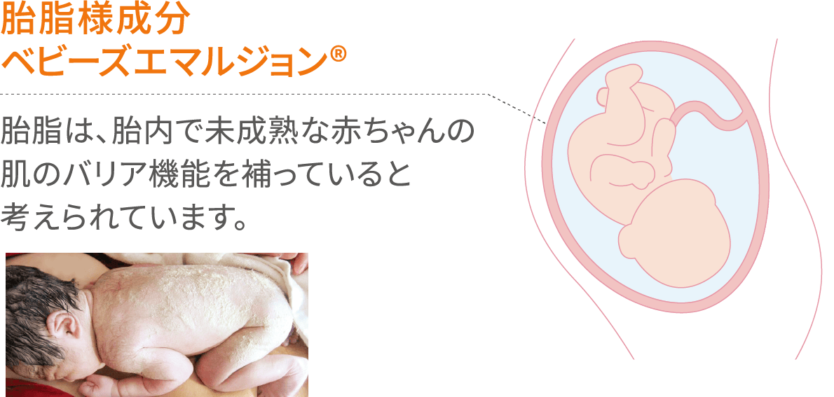 胎脂様成分ベビーズエマルジョン®:体脂は、胎内で未成熟な赤ちゃんの肌のバリア機能を補っていると考えられています。