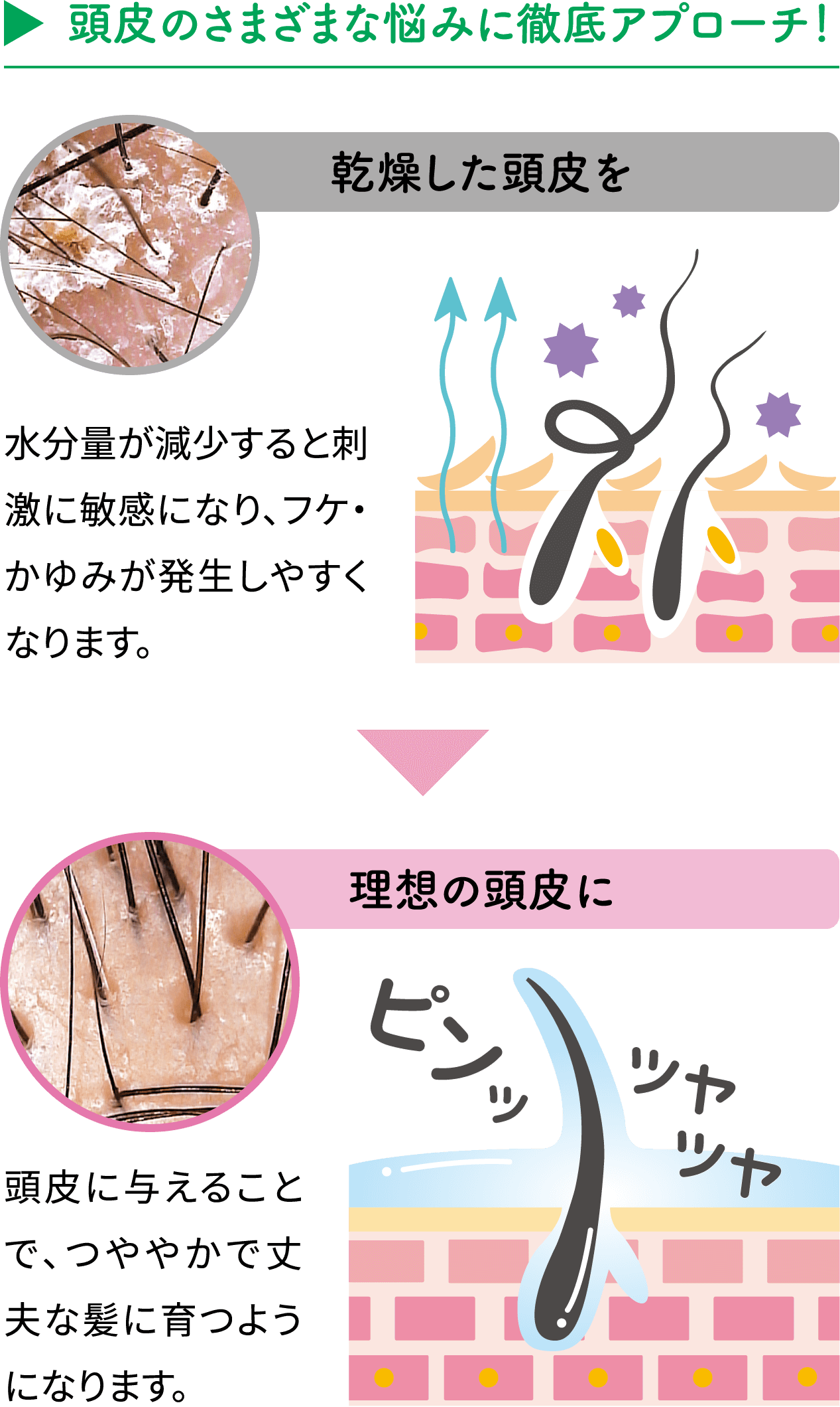 【頭皮のさまざまな悩みに徹底アプローチ!】乾燥した頭皮を理想の頭皮に。水分量が減少すると刺激に敏感になり、フケ・かゆみが発生しやすくなります。頭皮に与えることで、つややかで丈夫な髪に育つようになります。