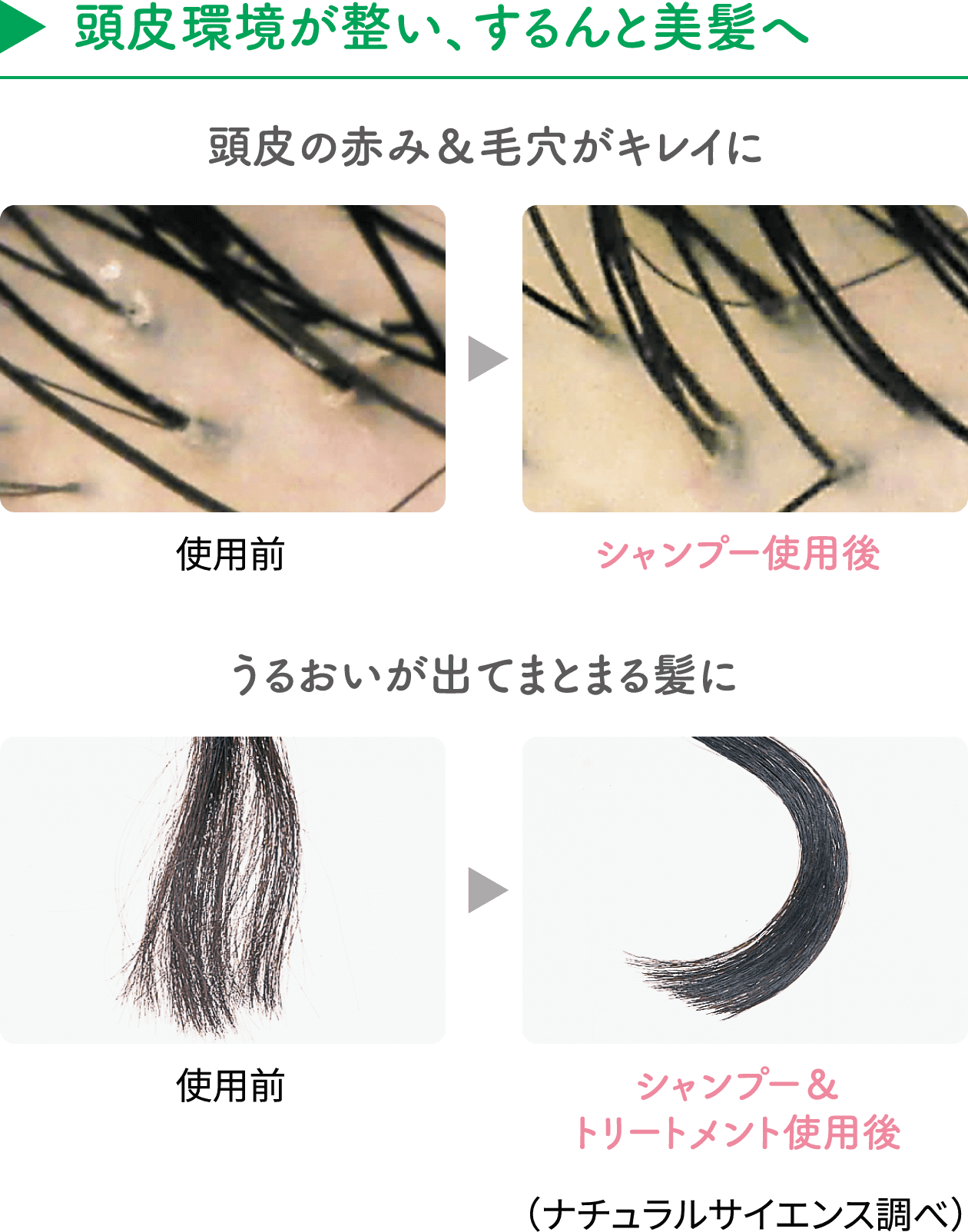 【頭皮環境が整い、するんと美髪へ】頭皮の赤み&毛穴がキレイに/うるおいが出てまとまる髪に(ナチュラルサイエンス調べ)
