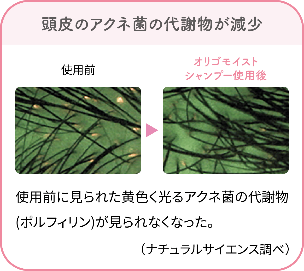 【頭皮環境が整い、するんと美髪へ】頭皮の赤み＆毛穴がキレイに／うるおいが出てまとまる髪に（ナチュラルサイエンス調べ）