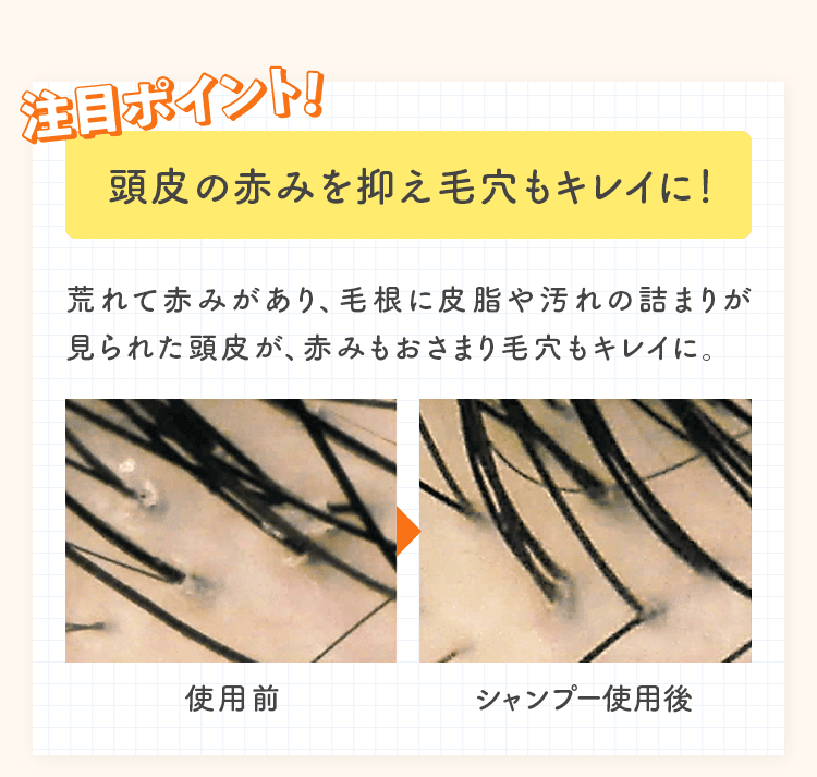 頭皮の赤みを抑え毛穴もキレイに！