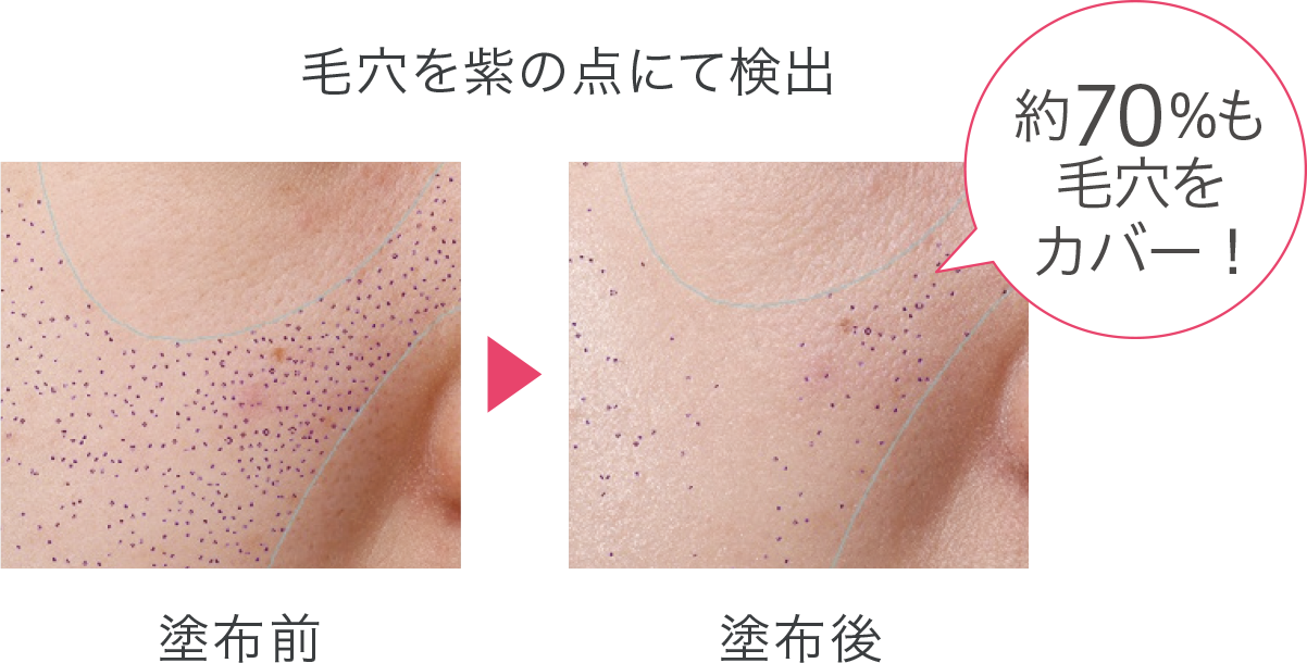 毛穴の目立ち方の変化を比較