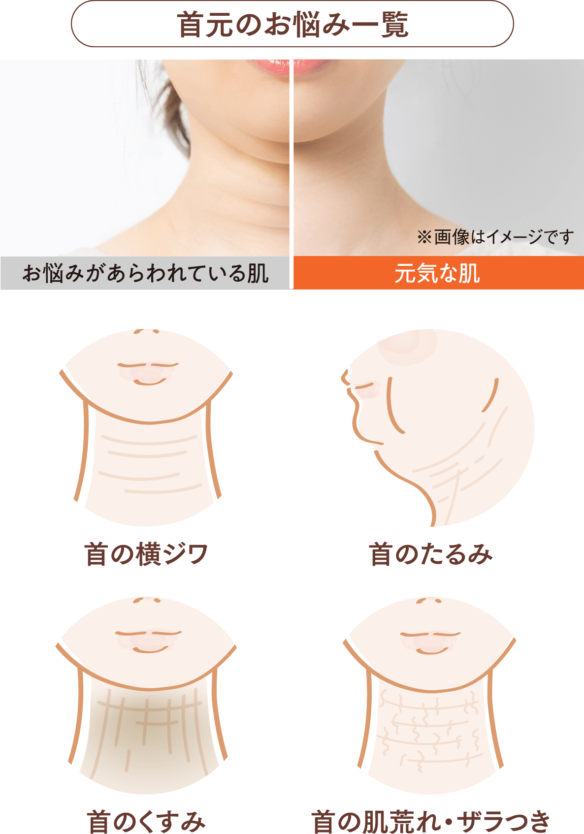[首元のお悩み一覧]お悩みがあらわれている肌と元気な肌の比較写真 / 首の横ジワ / 首のたるみ / 首のくすみ / 首の肌荒れ・ザラつき