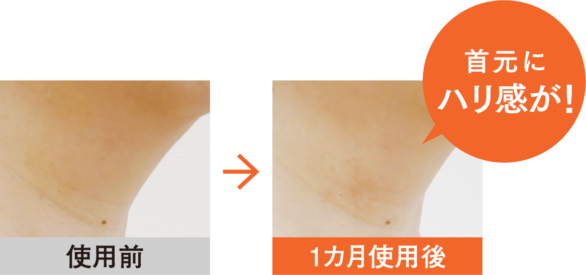 使用前→1ヶ月使用後には首元にハリ感が！