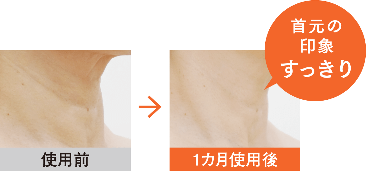 使用前→1ヶ月使用後には首元の印象がすっきり