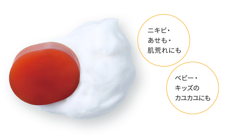ニキビ・あせも・肌荒れにも　ベビー・キッズのカユカユにも