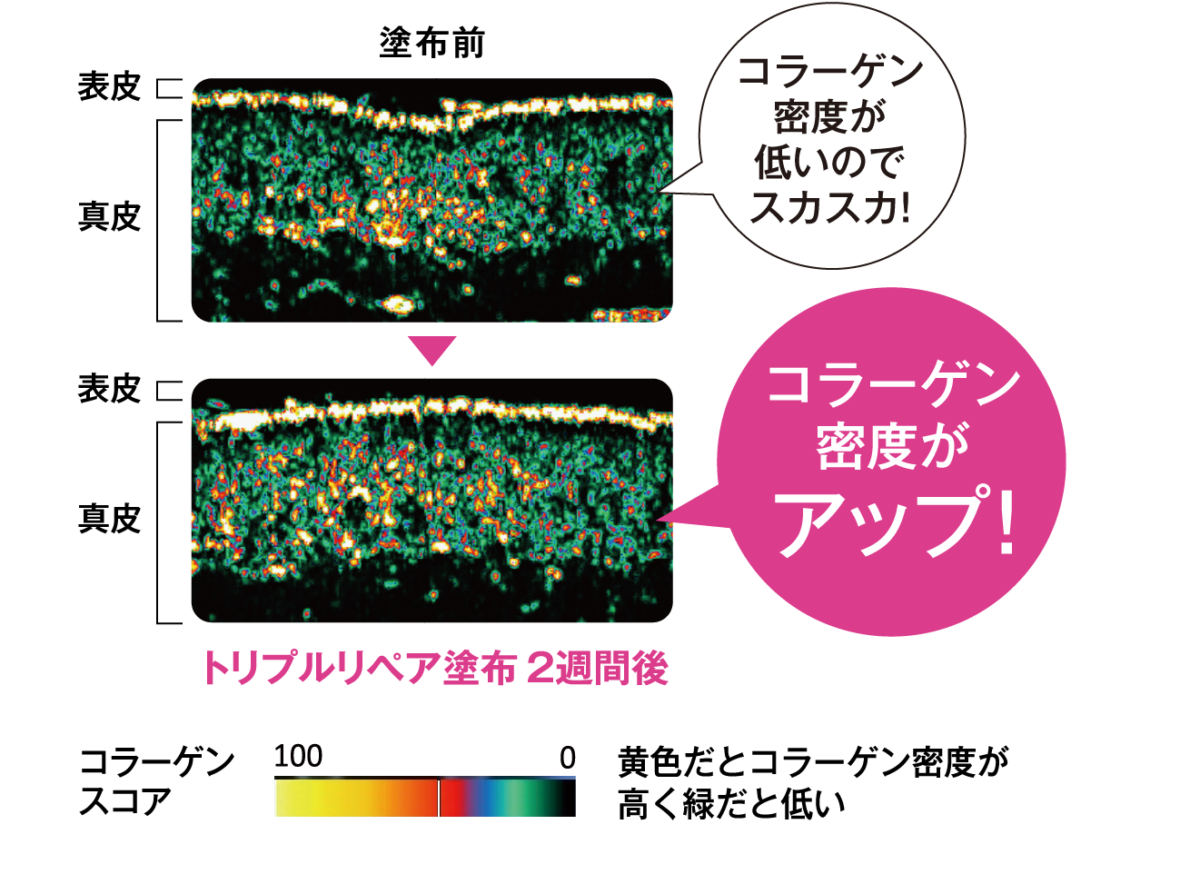 コラーゲン密度がアップ！