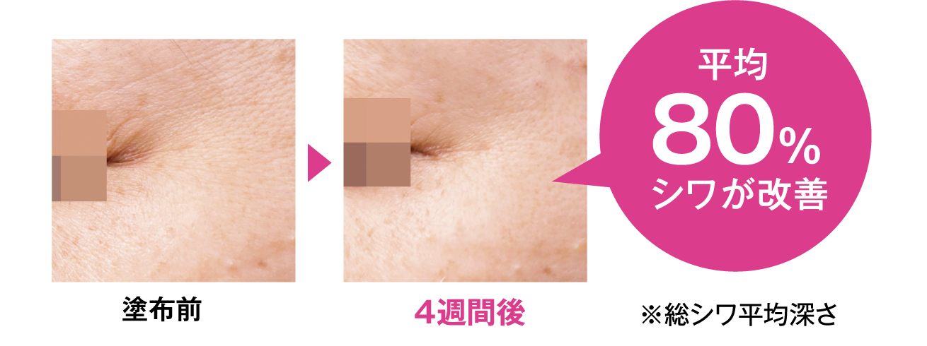 平均80%シワが改善！
