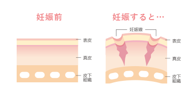 妊娠前と妊娠後の比較