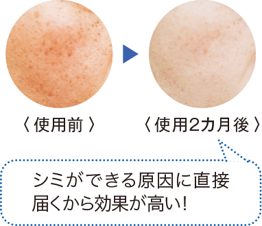 使用前と使用2カ月後の比較