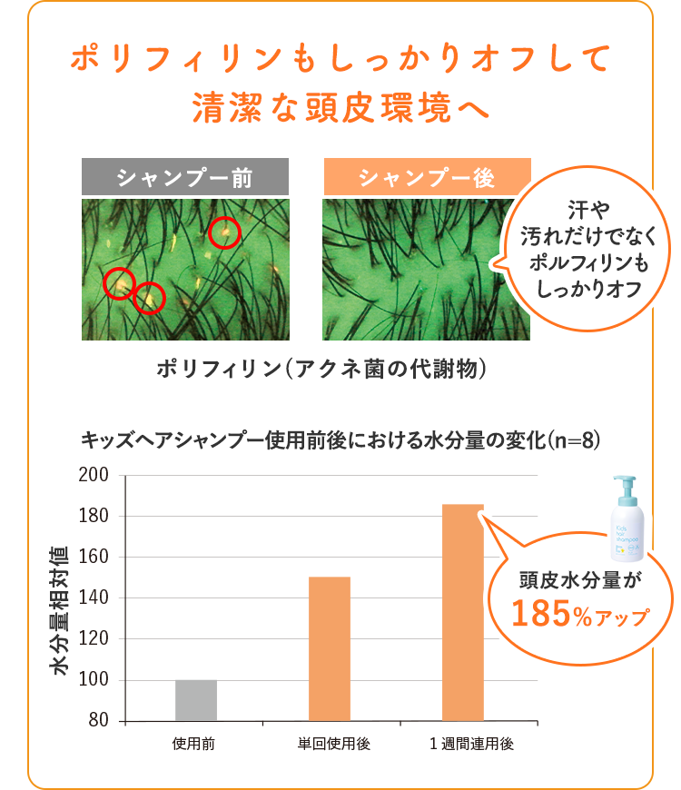 ポリフィリン菌もしっかりオフして清潔な頭皮環境へ