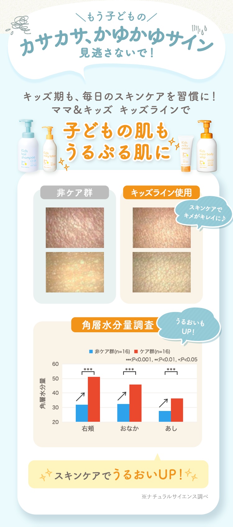 もう子どものカサカサ、かゆかゆサイン見逃さないで！｜キッズ期も、毎日のスキンケアを習慣に！ママ&キッズ キッズラインで子どもの肌もうるぷる肌に